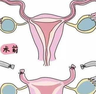 泰国试管一般多少钱呢？