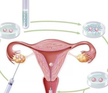 黑龙江哈尔滨有哪些私人机构提供试管婴儿助孕服务？